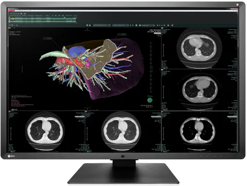 EIZO RadiForce RX660 LED display 76,2 cm (30") 3280 x 2048 pixels WQSXGA Noir, Blanc